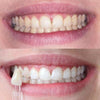 Valkoiset hampaat valkaisevalla hammastahnalla