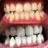 Hampaiden valkaisuun vaahto hampaiden valkaisuun